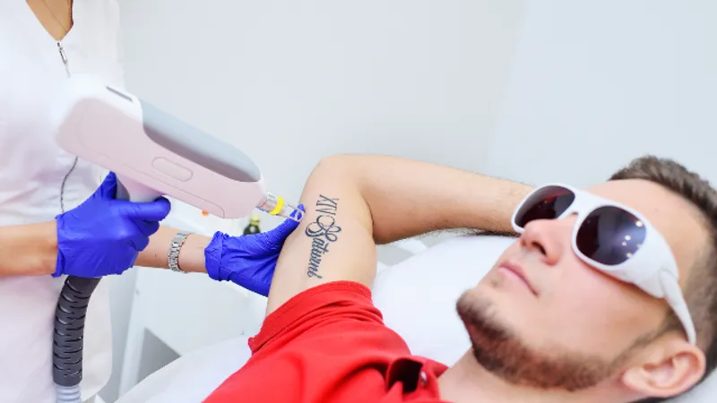 TAE-SFCT in Korea: Scar Treatment and Tattoo Removal