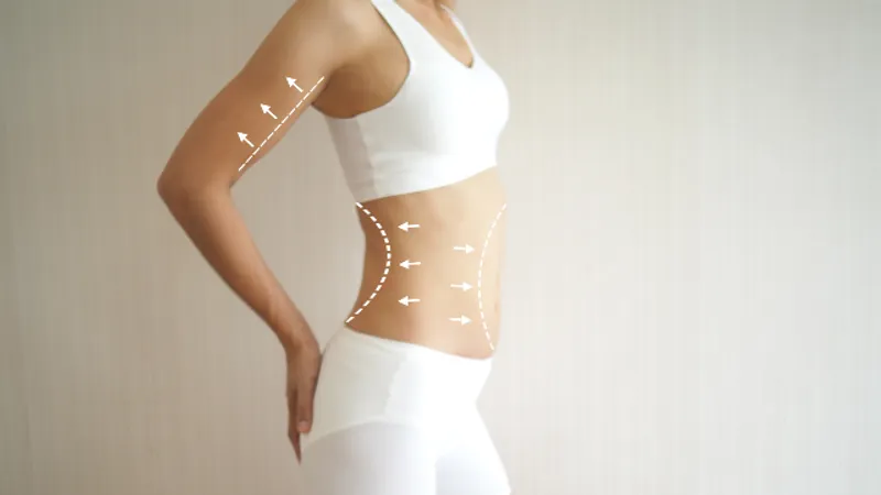 Renuvion Tightening vs Liposuction Alone: What Changes