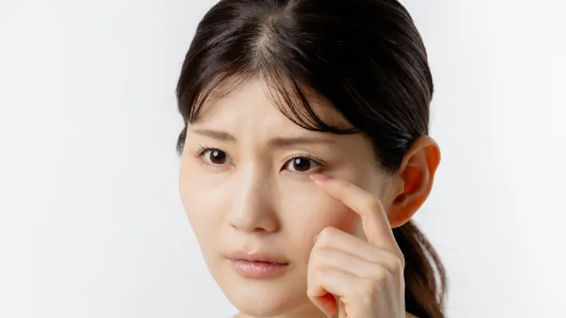 Eye Shape, Fat Volume and Skin Thickness in Under-Eye Care